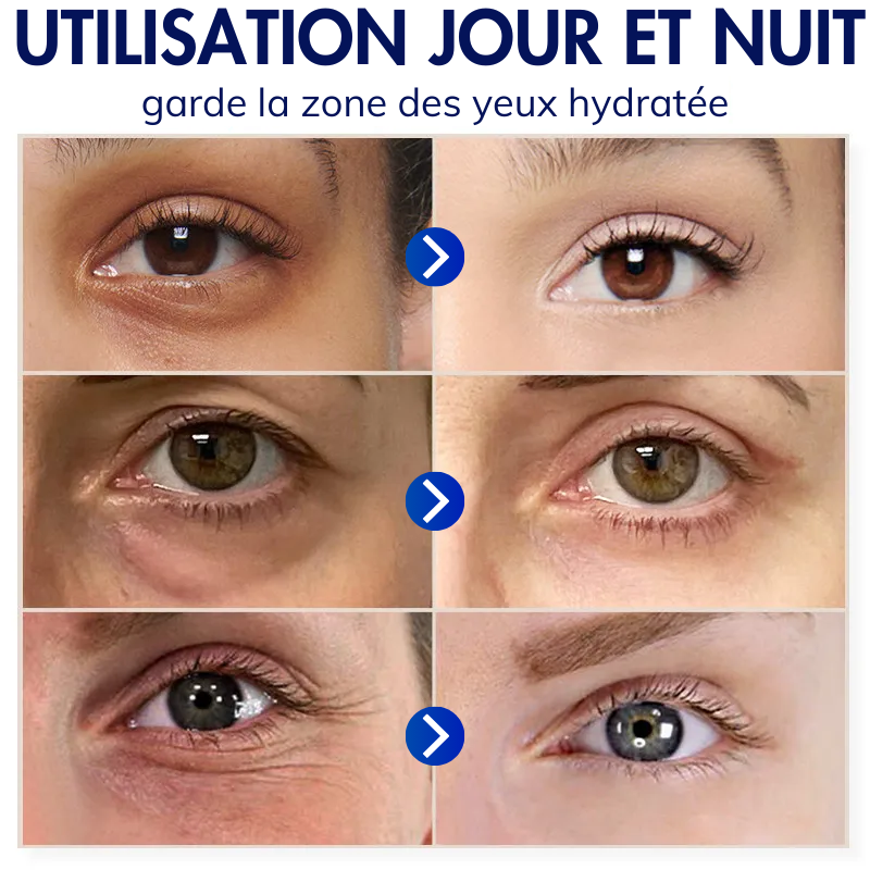 Dobshow™ Crème Avancée pour la Jeunesse des Yeux