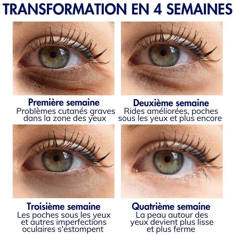 Dobshow™ Crème Avancée pour la Jeunesse des Yeux