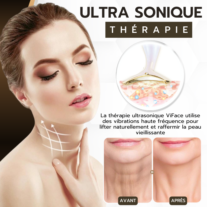 ViFace Lifting facial ultrasonique