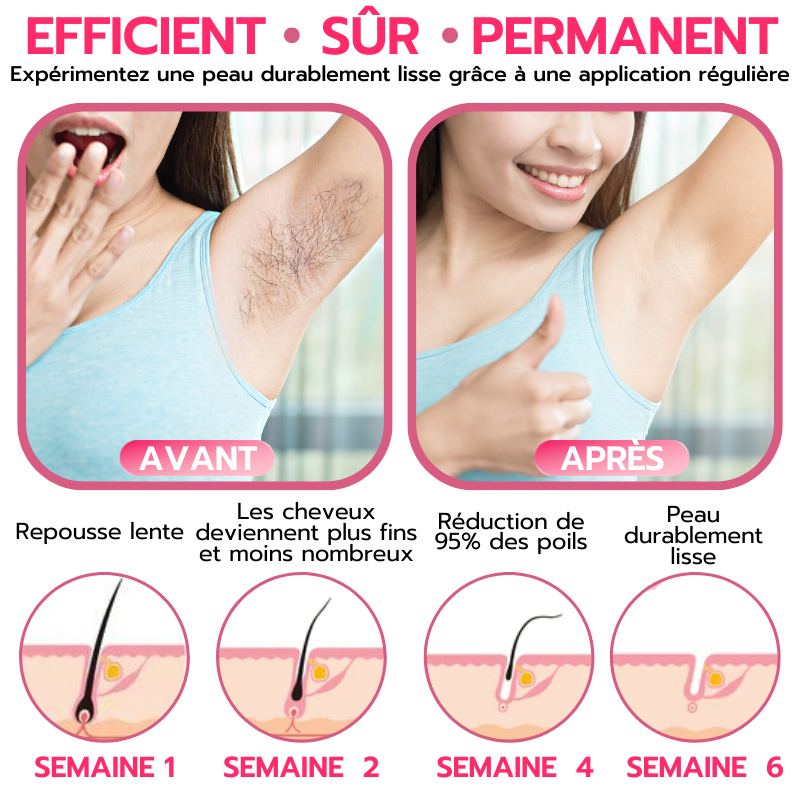 Softee™ Mousse d'épilation à la cire d'abeille